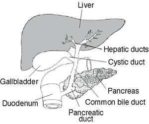 Liver cleanse, gallbladder cleanse, hepatic bile ducts cleanse, Gallstones flush, avoid surgery 